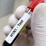 अलीगढ़ में स्वाइन फ्लू के 9 नए मरीज मिले, संक्रमितों की संख्या 40 पहुंची; 188 संदिग्धों की जांच