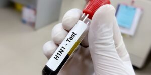अलीगढ़ में स्वाइन फ्लू के 9 नए मरीज मिले, संक्रमितों की संख्या 40 पहुंची; 188 संदिग्धों की जांच