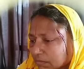 दुस्साहस:-घर-में-घुसकर-दबंगों-ने-महिला-को-पीटा,-वो-चीखती-रही…नहीं-आया-रहम;-थाने-पर-भी-हुआ-ये-सुलूक