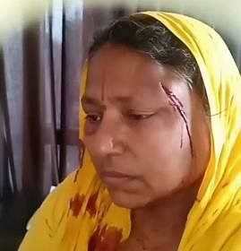 दुस्साहस:-घर-में-घुसकर-दबंगों-ने-महिला-को-पीटा,-वो-चीखती-रही…नहीं-आया-रहम;-थाने-पर-भी-हुआ-ये-सुलूक