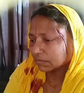 दुस्साहस:-घर-में-घुसकर-दबंगों-ने-महिला-को-पीटा,-वो-चीखती-रही…नहीं-आया-रहम;-थाने-पर-भी-हुआ-ये-सुलूक