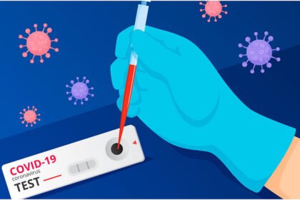 lucknow-news:-राजधानी-में-कोरोना-का-दूसरा-केस-मिला,-निजी-लैब-में-महिला-की-जांच-रिपोर्ट-आई-पॉजिटिव