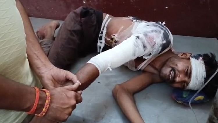 lakhimpur-kheri:-खेत-में-चारा-काटने-गए-पिता-पुत्र-पर-बाघ-ने-किया-हमला,-दोनों-गंभीर-घायल,-इलाके-में-दहशत