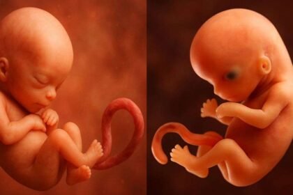 दुनिया-का-सबसे-उम्रदराज-शिशु,-30-साल-पुराने-भ्रूण-से-हुआ-पैदा,-जानिए-कैसे-हुआ-ये-संभव