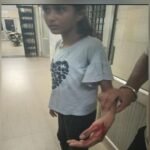 meerut:-भाजपा-नेता-की-दस-साल-की-बेटी-पर-कुत्तों-के-झुंड-का-हमला,-मासूम-का-हुआ-ये-हाल,-दिल्ली-करना-पड़ा-रेफर