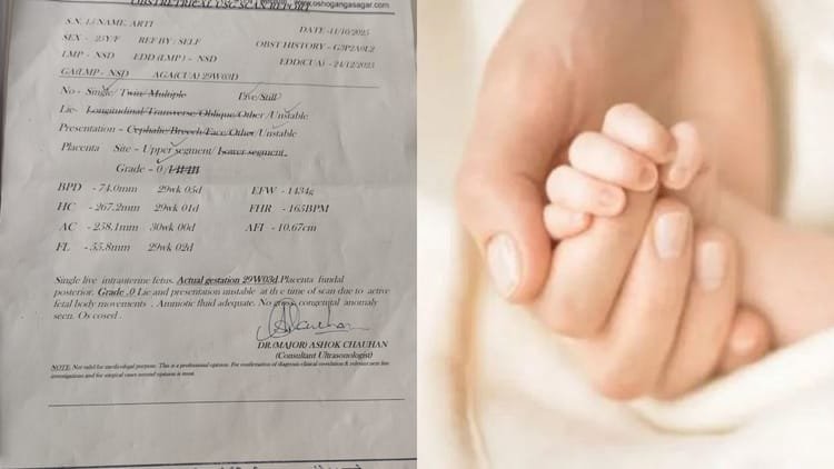 तीन-दिन-में-दो-अजीब-मामले:-बरेली-में-पहले-जुड़वां-की-जगह-जन्मा-एक,-अब-एक-के-बजाय-जन्मे-दो-बच्चे