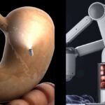 चीन-ने-किया-दुनिया-का-बड़ा-कमाल,-ai-पावर्ड-कैप्सूल-खाने-से-हो-जाएगी-पेट-की-जांच;-एंडोस्कोपी-की-पीड़ा-से-छुट्टी