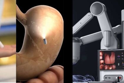 चीन-ने-किया-दुनिया-का-बड़ा-कमाल,-ai-पावर्ड-कैप्सूल-खाने-से-हो-जाएगी-पेट-की-जांच;-एंडोस्कोपी-की-पीड़ा-से-छुट्टी