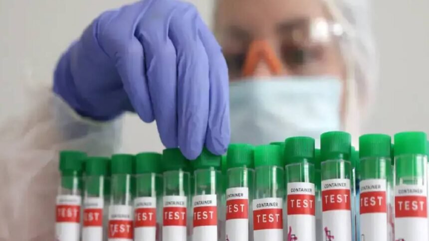 देश-के-इस-इलाके-में-फैला-बर्ड-फ्लू,-h5n1-वायरस-से-सैकड़ों-कौवों-की-मौत;-सरकार-ने-जारी-की-एडवाइजरी