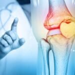 health:-क्यों-कमजोर-होने-लगी-हैं-बच्चों-की-हड्डियां?-लंबाई-भी-नहीं-बढ़-रही;-चिकित्सकों-ने-बताई-मुख्य-वजह