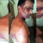 up:-कमरे-में-बांधकर-डाला,-बेल्ट-और-केबल-से-पीटा,-रिश्तेदार-से-उधार-के-एक-लाख-रुपये-मांगने-पर-मिली-ये-सजा