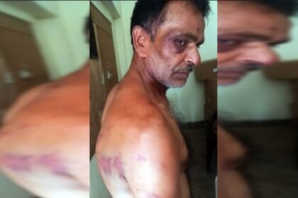 up:-कमरे-में-बांधकर-डाला,-बेल्ट-और-केबल-से-पीटा,-रिश्तेदार-से-उधार-के-एक-लाख-रुपये-मांगने-पर-मिली-ये-सजा