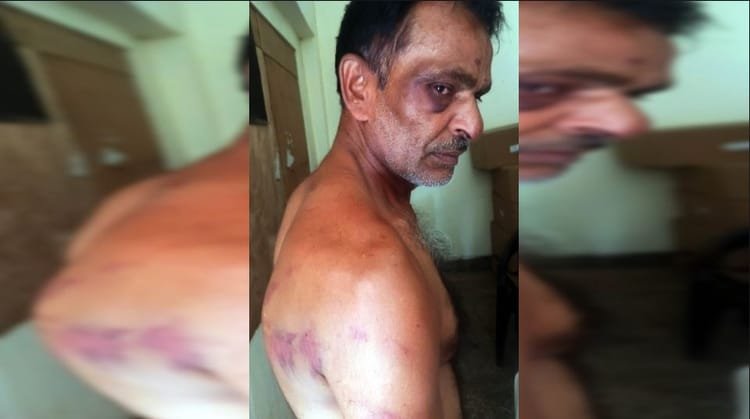 up:-कमरे-में-बांधकर-डाला,-बेल्ट-और-केबल-से-पीटा,-रिश्तेदार-से-उधार-के-एक-लाख-रुपये-मांगने-पर-मिली-ये-सजा